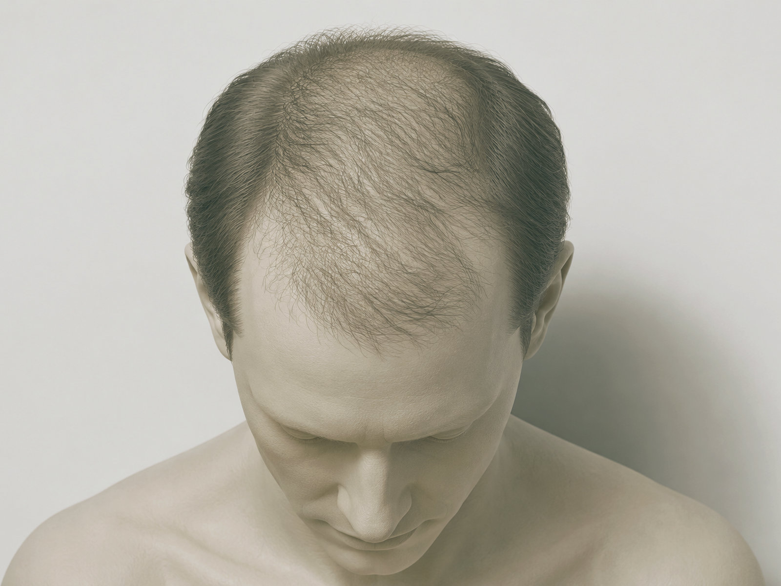 Perte de cheveux